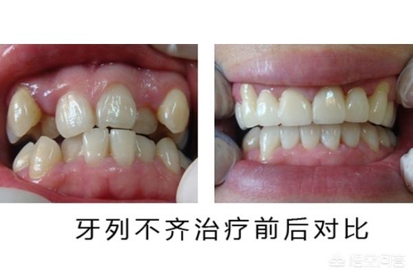 东阳最新24小时牙医在线咨询方法分析(最方便真实的东阳有没有24小时牙医方法)